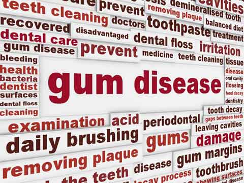 gum disease illustration