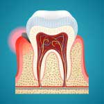 Diagram of a tooth