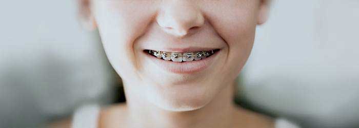 Girl wearing braces