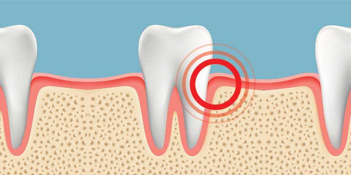 Diagram of teeth and gums