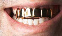 Dental grills